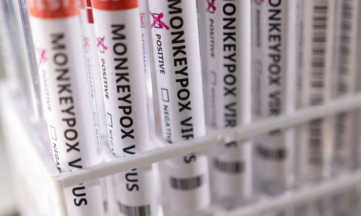 Moçambique conta com mais 16 pessoas infectadas com mpox