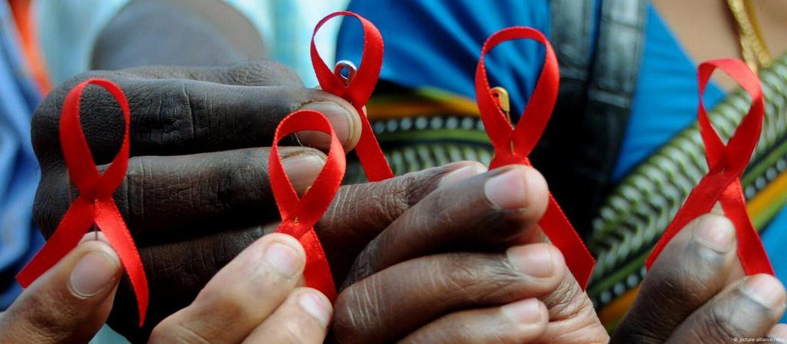 Cerca de 44 mil pessoas morreram vítimas de hiv/sida em