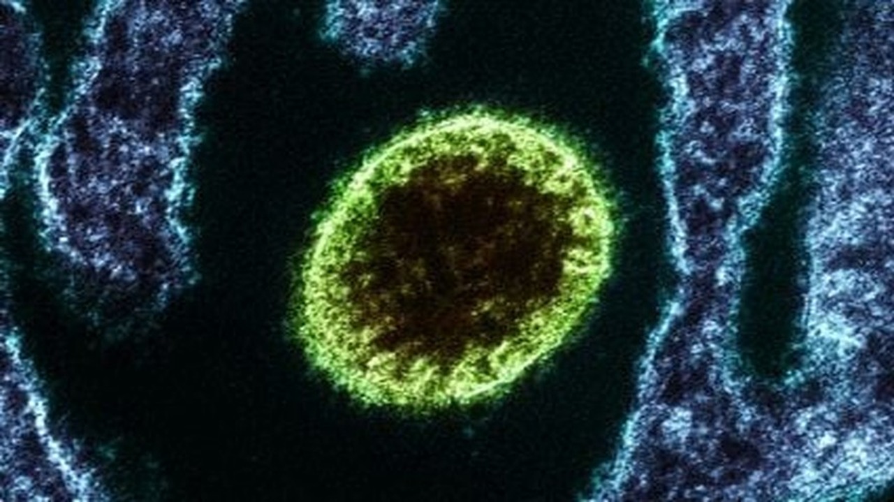 Índia confirma surto de vírus Nipah em Bengala Ocidental e