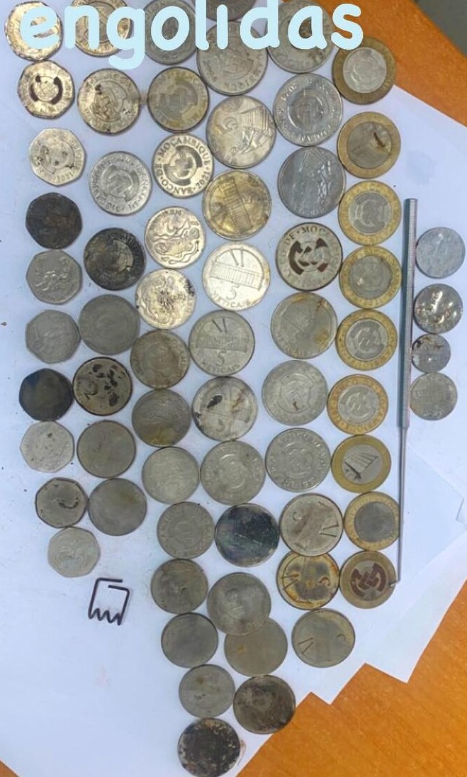 Pelo menos 250 meticais em moedas retirados de órgãos internos