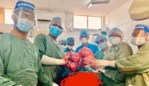 Equipa do Hospital Central de Nampula remove mioma gigante de