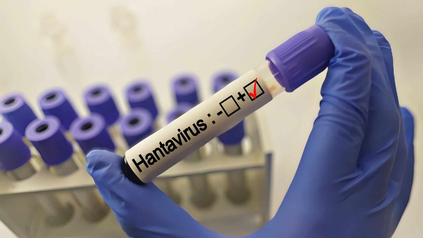 OMS garante que o risco de propagação de hantavírus é