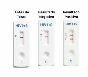ANARME suspende testes rápidos para HIV, malária e sífilis da