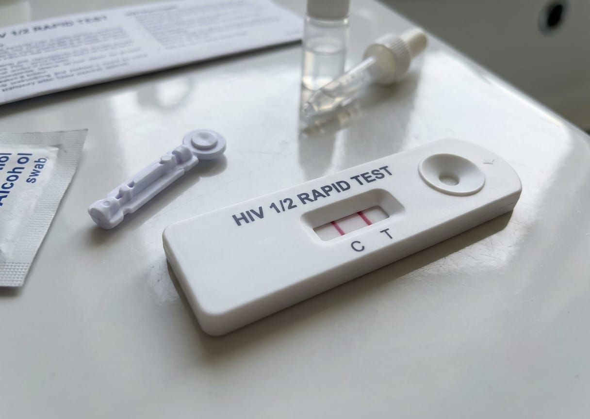 Epidemia de HIV ameaça voltar a ganhar força e preocupa