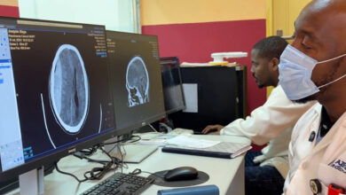 Hospital Provincial de Chimoio realiza primeira craniotomia de emergência - O País
